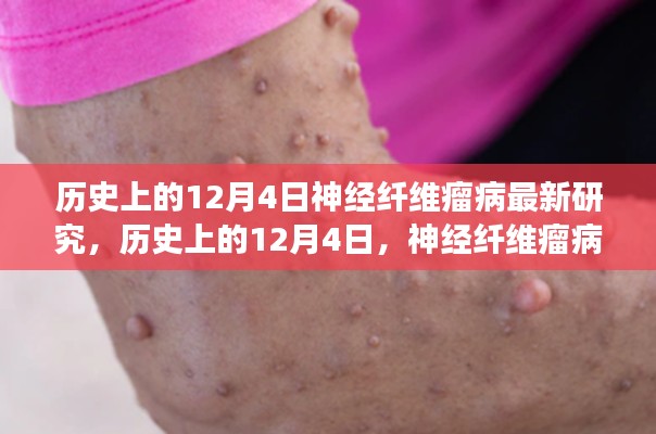 歷史上的神經(jīng)纖維瘤病研究之旅，與自然美景共舞，探尋內(nèi)心寧靜港灣的新突破