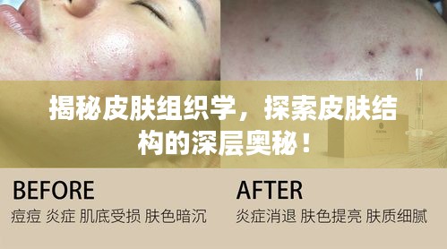 揭秘皮膚組織學(xué)，探索皮膚結(jié)構(gòu)的深層奧秘！