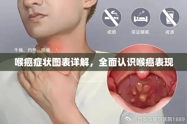 喉癌癥狀圖表詳解，全面認(rèn)識(shí)喉癌表現(xiàn)